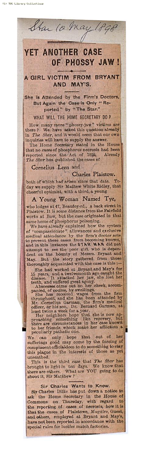 Yet another case of phossy jaw! - A girl victim from Bryant and May's, 'The Star' 10 May 1898